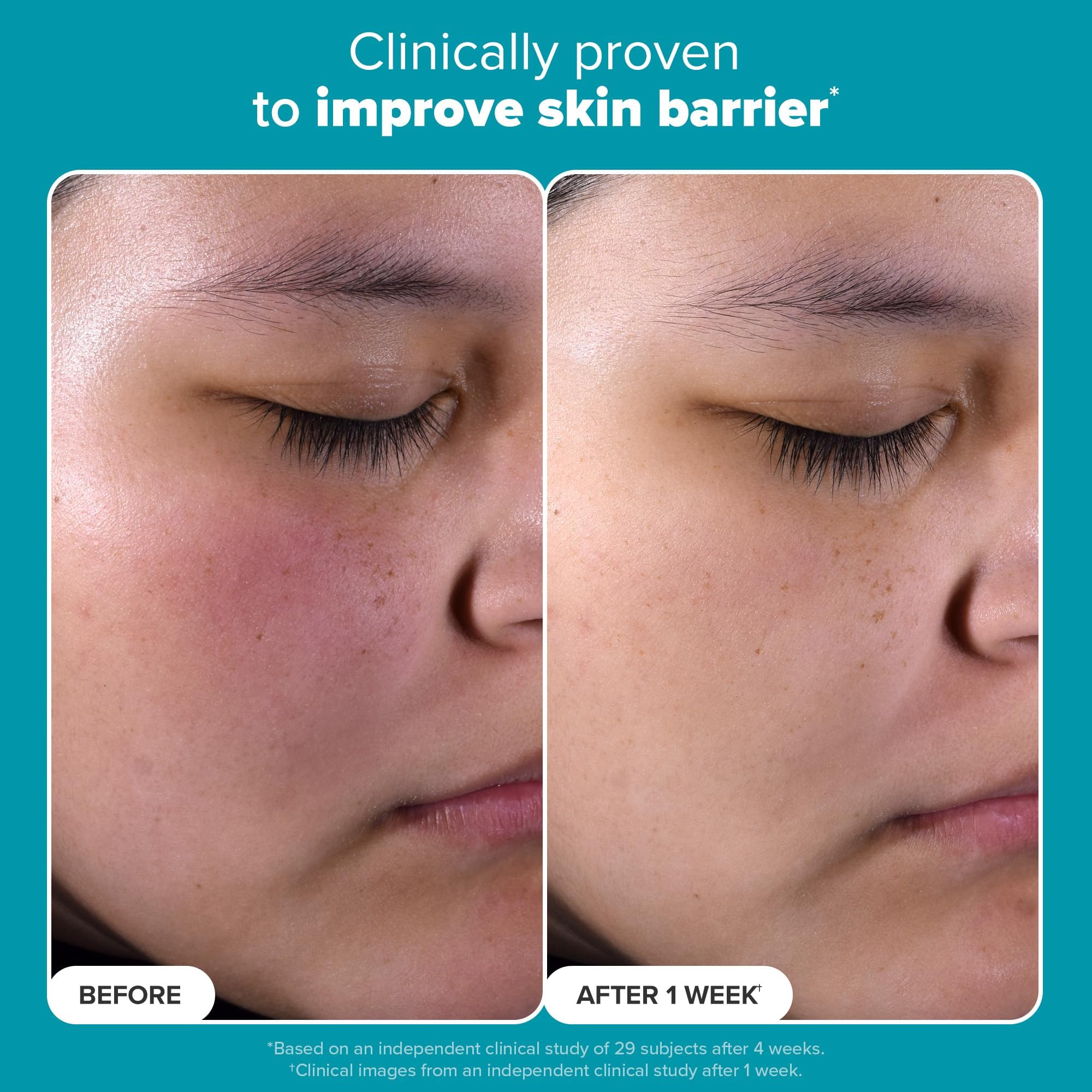 Paula's Choice Exfoliant