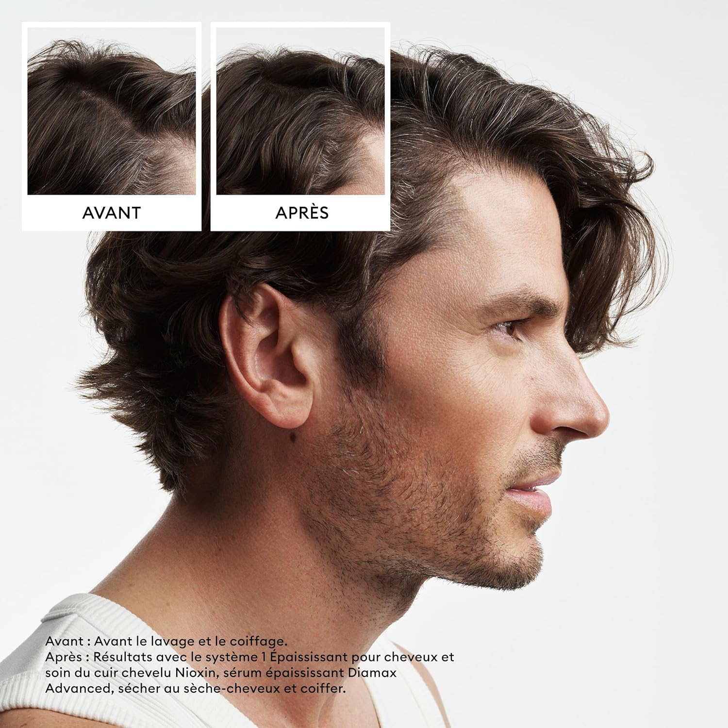 Nioxin Scalp Shampoo